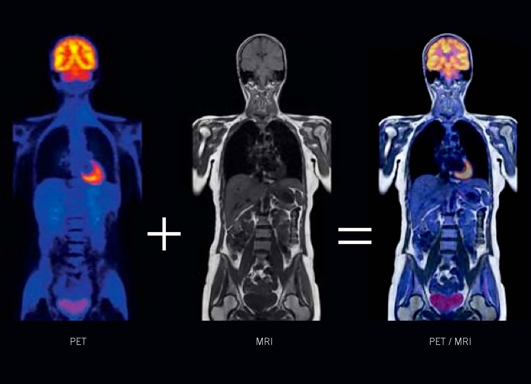 PET MRI Stony Brook University School Of Medicine